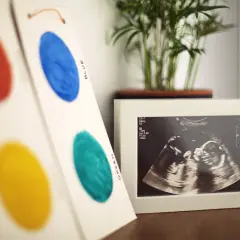 Kiedy widac bicie serca na usg, to cudowny moment. Obrazek USG z maleństwem w ramce, obok kolorowe kropki.