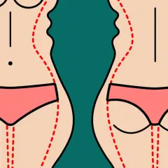 Przed i po liposukcji ultradźwiękowej: zarys sylwetki przed zabiegiem (falisty) i po (gładszy).