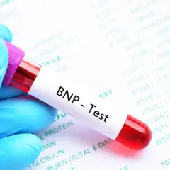 Blauer Handschuh hält Blutprobe für BNP-Test. Laborbericht im Hintergrund zeigt verschiedene Werte, darunter den BNP Wert.