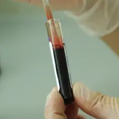 Czy leki na HIV są refundowane? Sprawdź, co musisz wiedzieć o dostępności