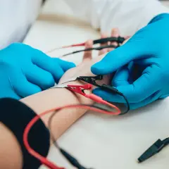 Badanie EMG, czyli elektromiografia, to badanie oceniające funkcję nerwów i mięśni. Na zdjęciu widać elektrody podłączone do ręki pacjenta.