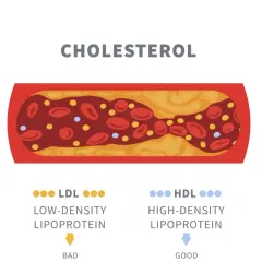 Przekrój naczynia krwionośnego z cholesterolem LDL (złym) i HDL (dobrym). Za niski cholesterol HDL może być problemem.