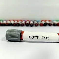 Probówka z oznaczeniem "OGTT - Test" na tle wielu innych próbek krwi.