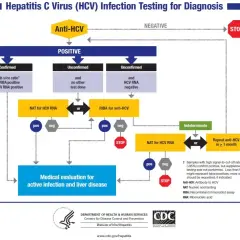 Schemat diagnostyki zakażenia HCV. Wyjaśnia, hcv co to za badanie i jakie są kolejne kroki po uzyskaniu wyników.