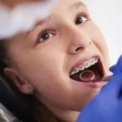 Ortodonta czy dentysta? Kto założy aparat na zęby?