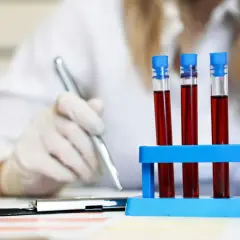 Naukowczyni w białej rękawiczce analizuje próbki krwi w probówkach. W tle widać jej rękę z długopisem, jakby notowała wyniki.