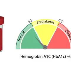 Wskaźnik HBA1C pokazuje poziom cukru we krwi: zielony (norma), żółty (stan przedcukrzycowy), czerwony (cukrzyca). Obok probówka z krwią.