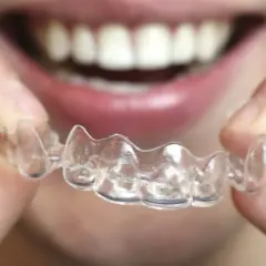 Persona sonríe mostrando una férula de ortodoncia invisible. Averigua cuanto tiempo dura la ortodoncia invisible.