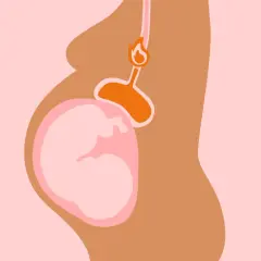 Illustration d'une femme enceinte montrant le bébé et l'estomac, avec une flamme symbolisant le **remonter acide grossesse**.
