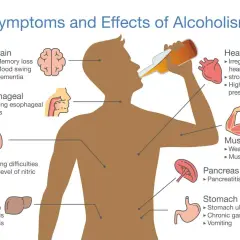Ilustracja pokazuje objawy i skutki picia alkoholu, w tym nieodwracalne skutki dla mózgu, serca, płuc, wątroby, trzustki, żołądka i mięśni.