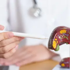 Lekarz wskazuje na model wątroby, omawiając chemioterapię na przerzuty do wątroby.