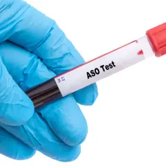 Ręka w niebieskiej rękawiczce trzyma probówkę z napisem "ASO Test".