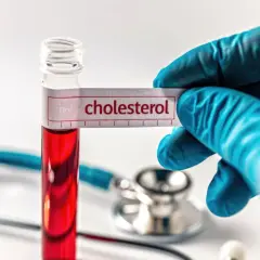 Jaki lekarz leczy cholesterol i jak uniknąć poważnych problemów zdrowotnych