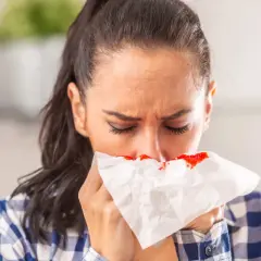 Kobieta z krwią z nosa na chusteczce. Zastanawia się nad przyczynami krwawienia.
