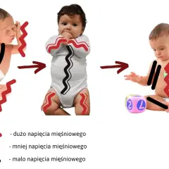 Postęp w ćwiczeniach na obniżone napięcie mięśniowe: od nadmiernego napięcia do swobodnych ruchów.