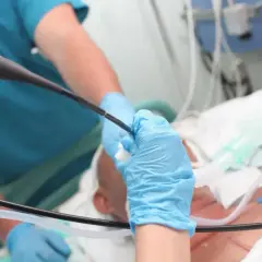 Lekarz w niebieskich rękawiczkach wykonuje bronchoskopię, wprowadzając endoskop do dróg oddechowych pacjenta.