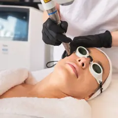 Kobieta w okularach ochronnych poddaje się zabiegowi laserowego liftingu twarzy.