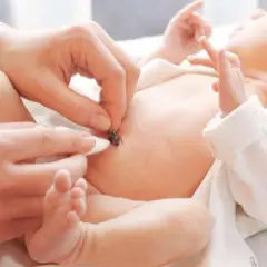 Delikatna pielęgnacja pępka noworodka. Dłoń rodzica z wacikiem czyści pozostałość pępowiny, dbając o zdrowie maluszka.