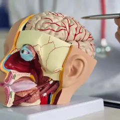 Medizinisches Modell eines Kopfes mit Gehirn, Auge und Mund. Ein Arzt erklärt, was nach dem Essen Kopfdruck verursachen könnte.