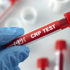 Ręka w niebieskiej rękawiczce trzyma probówkę z napisem "CRP TEST". To badanie pozwala ocenić poziom białka c-reaktywnego, wskaźnika stanu zapalnego.