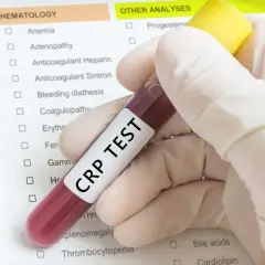 Ręka w rękawiczce trzyma probówkę z napisem "CRP TEST". Wartość jak wysokie crp powinno niepokoić, jest kluczowa dla diagnozy.