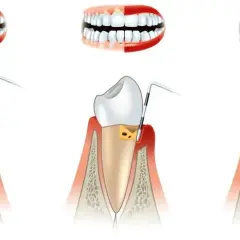 Choroby jamy ustnej: Jaki lekarz? Periodontolog wyjaśnia