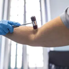 Lekarz w niebieskich rękawiczkach bada odruch TOB u pacjenta, używając młoteczka neurologicznego.