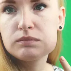 Kobieta z widocznym obrzękiem policzka, wskazującym na ropień zęba.