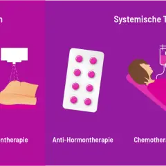 Illustration zeigt lokale und systemische Therapien bei Brustkrebs: Operation, Strahlentherapie, Hormontherapie, Chemotherapie, zielgerichtete Therapie.