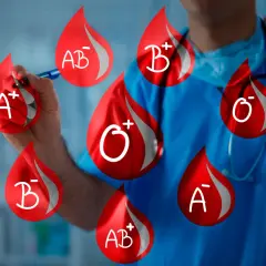 Läkare markerar olika blodgrupper, inklusive rh positiv.
