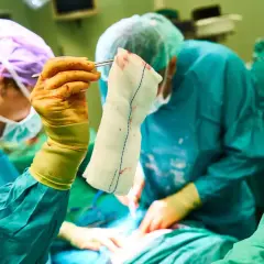 Chirurghi in sala operatoria. La mano guantata tiene una garza insanguinata, un dettaglio che potrebbe far pensare alle tabelle risarcimento malasanità morte.