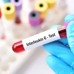 Ręka w niebieskiej rękawiczce trzyma probówkę z krwią do testu na interleukinę 6. Cytokiny co to? To białka sygnałowe układu odpornościowego.