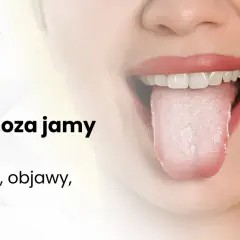 Kandydoza jamy ustnej: objawy, przyczyny i kiedy iść do lekarza