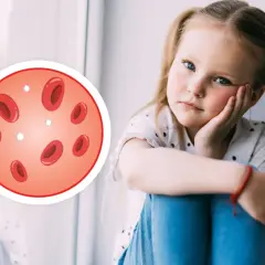 Smutna dziewczynka z niskimi leukocytami. Obok niej okrąg z czerwonymi krwinkami i kilkoma białymi, symbolizującymi niskie leukocyty.
