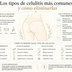 Infografía sobre los tipos de celulitis: edematosa, blanda, dura y mixta, y cómo tratarlas.