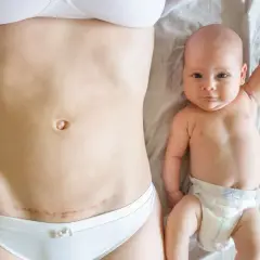Pierwszy spacer po cesarce. Mama z widoczną blizną na brzuchu i noworodek z podniesioną rączką leżą obok siebie.