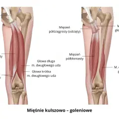 Anatomia mięśni kulszowo-goleniowych. Ilustracja pokazuje mięsień dwugłowy uda, który może powodować ból w podudziu.