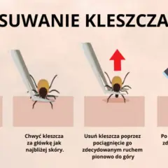 Jak bezpiecznie usunąć kleszcza? Instrukcja krok po kroku