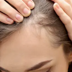 Dłonie dotykają linii włosów, pokazując drobne kosmyki. Dowiedz się, jak ujarzmić baby hair i cieszyć się gładką fryzurą.