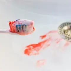 Szczoteczka do zębów z pianą i śladami krwi. W umywalce widać rozmazaną krew z zęba.