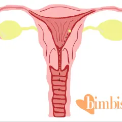 Utero con ovulo e tracce di sangue, possibile inizio di gravidanza o ovulazione.