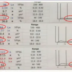 Wyniki badań krwi z zaznaczonymi parametrami P-LCC i P-LCR. Wartości P-LCR są w normie.