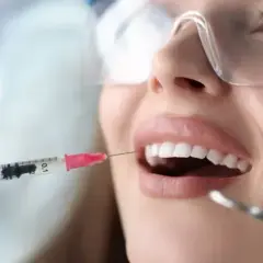 Drętwienie po dentyście: Kiedy minie? Wszystko o znieczuleniu