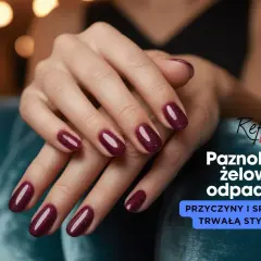 Dłonie z bordowymi paznokciami żelowymi. Dowiedz się, dlaczego żel odchodzi od wolnego brzegu i jak temu zapobiec.