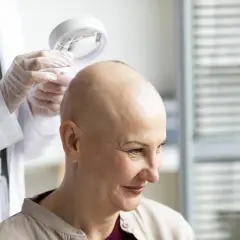 Lekarz bada skórę głowy pacjentki po chemioterapii, która mogła spowodować, że wypadły włosy.