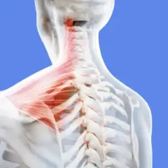 Vue anatomique du grand muscle du haut du dos, mettant en évidence la colonne vertébrale et les muscles du cou en rouge.