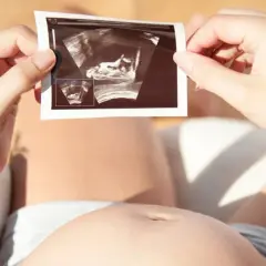 Kobieta trzyma zdjęcie USG, na którym widać zarodek. To nie lewatywa, a cud życia.