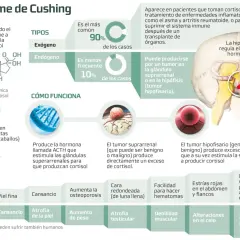 Infografía sobre el síndrome de Cushing, sus tipos, causas y síntomas en humanos y perros.