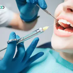 Znieczulenie u dentysty: Bezpieczne i bezbolesne? Poznaj fakty!