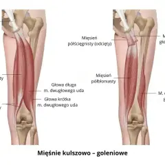 Anatomia mięśnia dwugłowego uda, pokazująca jego głowy długą i krótką oraz mięśnie półścięgnisty i półbłoniasty.